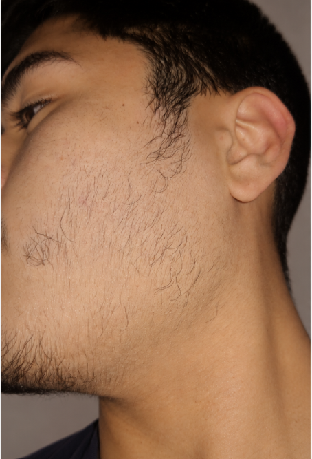 Before using the NOVAQ routine