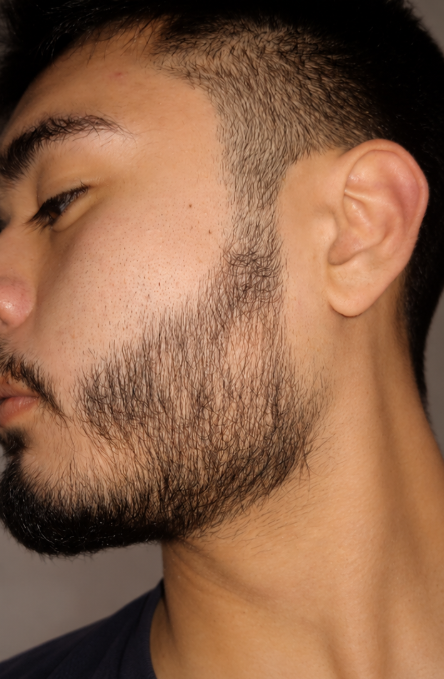 After using the NOVAQ routine
